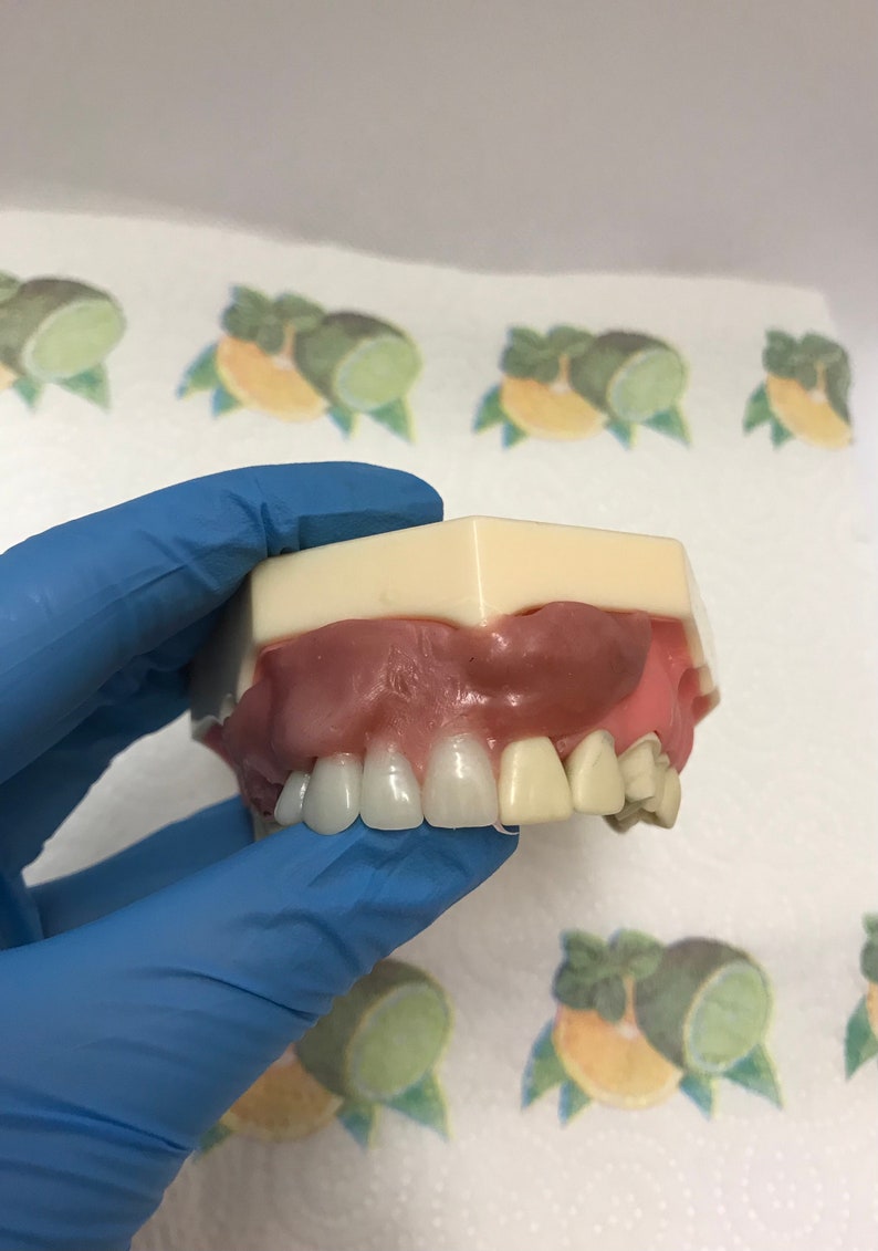 Denture Gum Material Repair DIY Kit Denture Reline Denture Etsy Canada