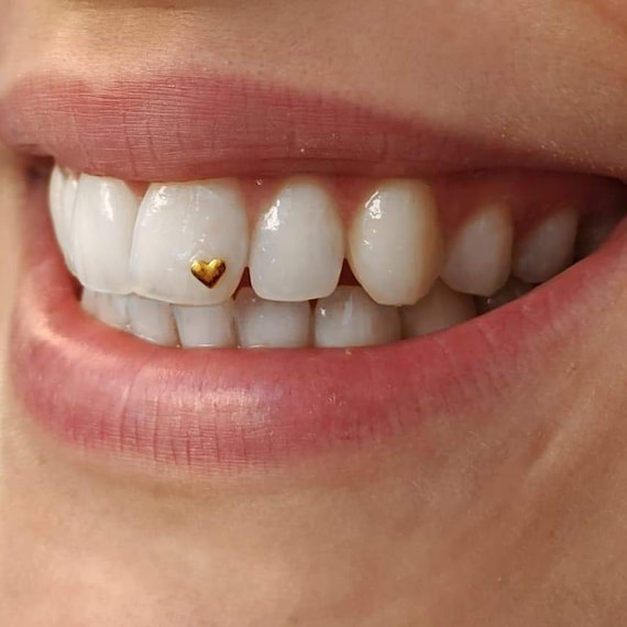 Gold Tooth Gem 22ct - Tiny Heart - Spread the love by smiling a lot!