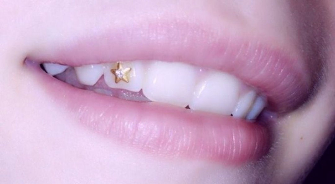 Tooth Gems & Dental Jewelry in Western & Central Florida