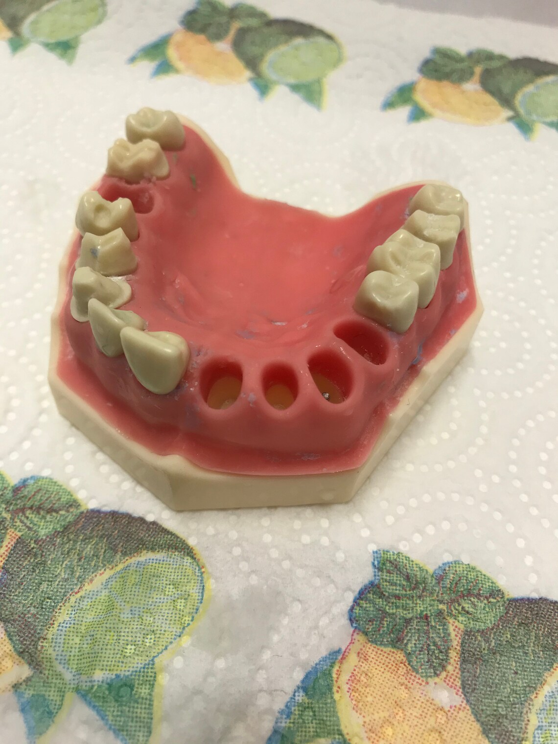 DIY Denture Kit Immediate Partial Denture Upper/Lower Resin Etsy