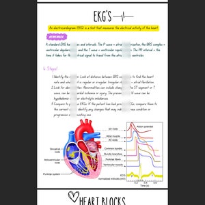 May include: A diagram of the heart with the electrical pathways highlighted. The diagram shows the SA node, AV node, bundle of His, Purkinje fibers, and ventricular muscle. The EKG waveform is shown below the diagram, with the P wave, QRS complex, and T wave labeled.