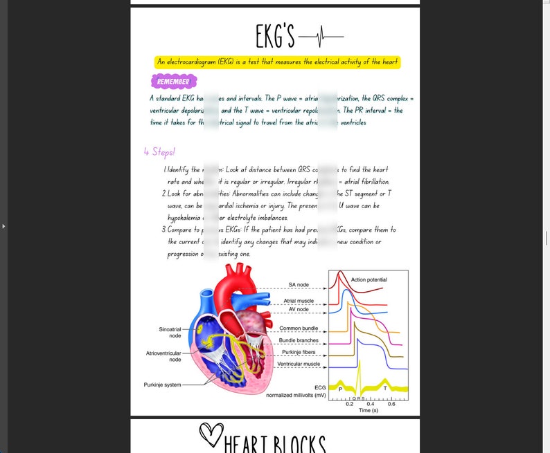 May include: A diagram of the heart with the electrical pathways highlighted. The diagram shows the SA node, AV node, bundle of His, Purkinje fibers, and ventricular muscle. The EKG waveform is shown below the diagram, with the P wave, QRS complex, and T wave labeled.