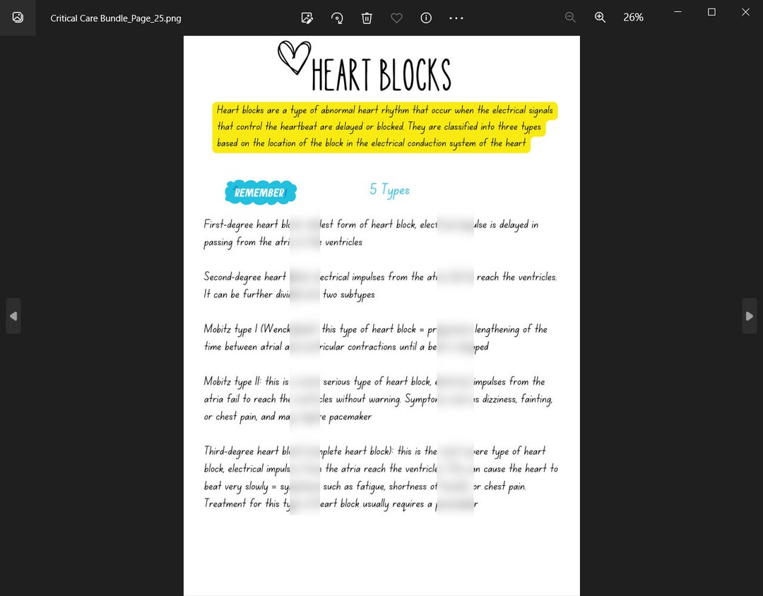 NCLEX Heart Blocks Handwritten Study Sheet What You Must Etsy