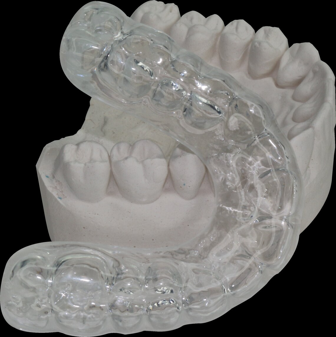 American Dentalcraft Custom Dental Guard Mouth Guard for Etsy