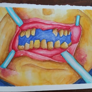 Look at my teeth