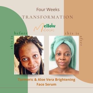 Puede incluir: Fotos de antes y despu&eacute;s que muestran los resultados del uso de un suero facial iluminador de c&uacute;rcuma y aloe vera. El texto "Four Weeks TRANSFORMATION" est&aacute; en la parte superior de la imagen. El texto "Mellow Melanin" est&aacute; en el centro de la imagen. El texto "this is before" est&aacute; en el lado izquierdo de la imagen. El texto "this is after" est&aacute; en el lado derecho de la imagen.