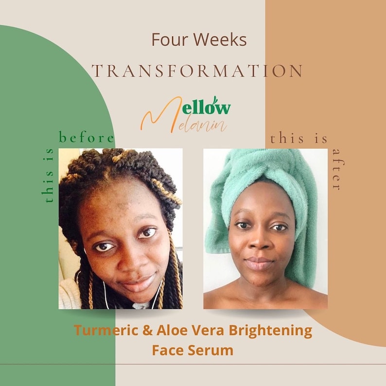 Puede incluir: Fotos de antes y despu&eacute;s que muestran los resultados del uso de un suero facial iluminador de c&uacute;rcuma y aloe vera. El texto "Four Weeks TRANSFORMATION" est&aacute; en la parte superior de la imagen. El texto "Mellow Melanin" est&aacute; en el centro de la imagen. El texto "this is before" est&aacute; en el lado izquierdo de la imagen. El texto "this is after" est&aacute; en el lado derecho de la imagen.
