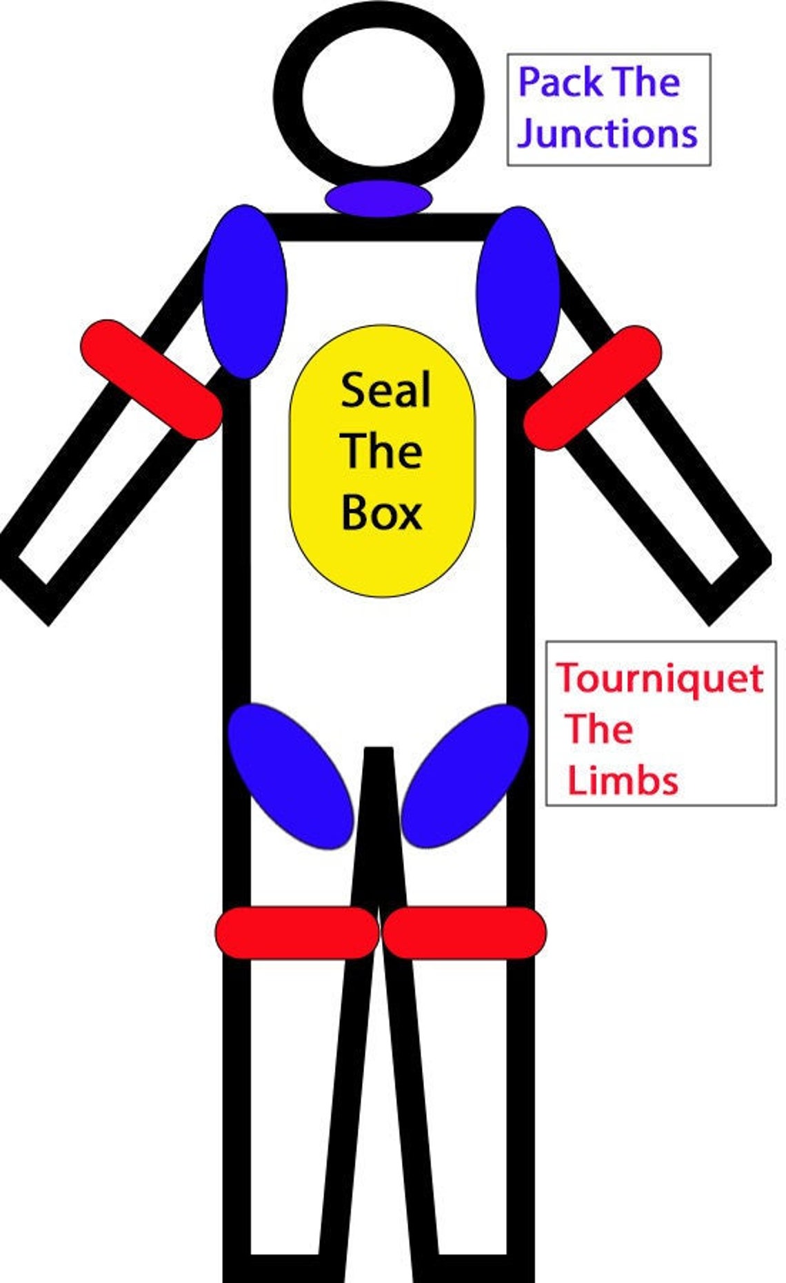 Tourniquet, Chest Seal, and Wound Packing Placement Infographic