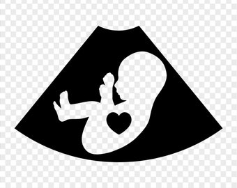sonography card etsy