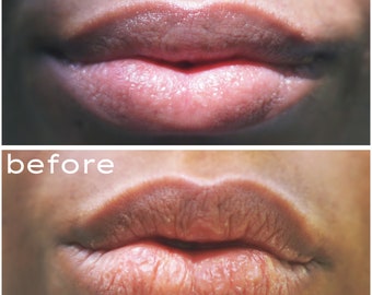 Lip Balm for Dry Lips| Silky Lip Balm| Daily Lip Care| Lip Care Moisture| Healing Lip Care