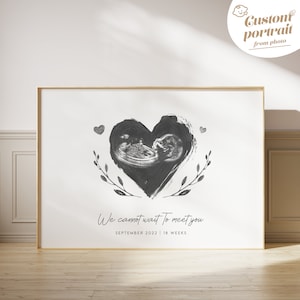 Benutzerdefinierte Baby Ultraschall Mutterschaft Kinderzimmer Dekor Baby Zimmer Dekor druckbare Aquarell Kunst fetal Ultraschall Bild neue Eltern Geschenk