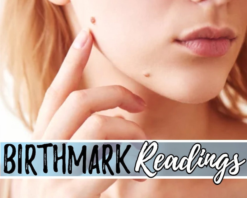 May include: Close-up of a person's face with two small brown birthmarks on their cheek. The text "BIRTHMARK Readings" is at the bottom of the image.