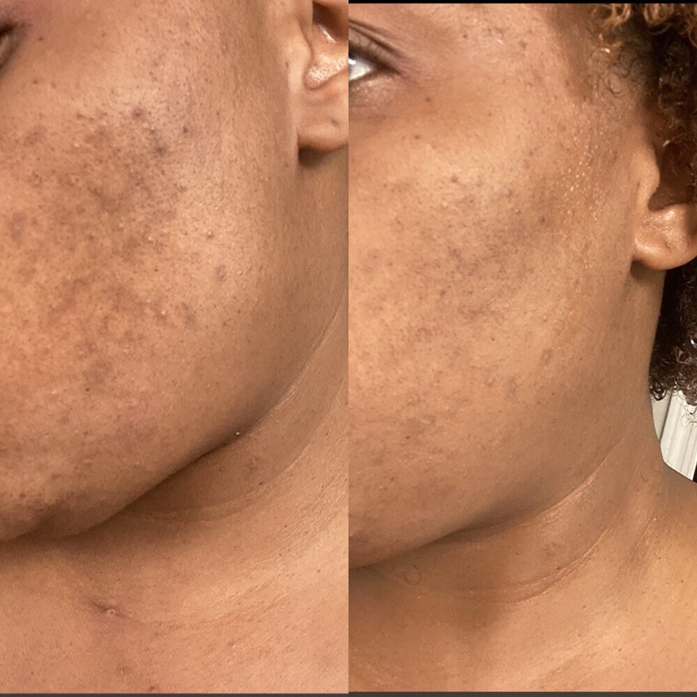 Turmeric face scrub Dark Spots Remover Glowing And Smooth Etsy