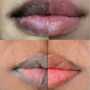 lightening smokers lips