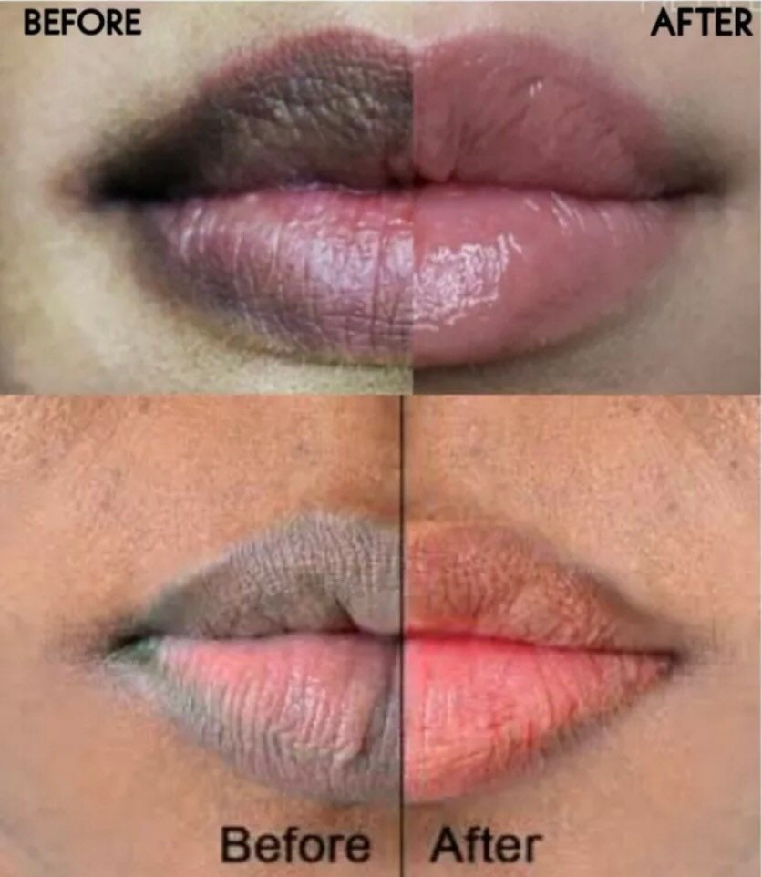 Lip lightening cream, smokers lip cream, pink lips cream, dark lips c…