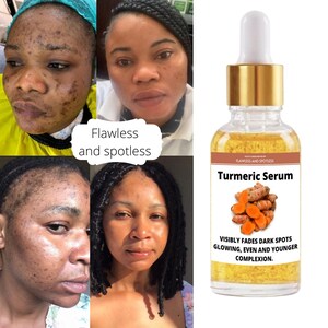 Turmeric serum, dark spot remover, glowing flawless skin, dark spot corrector