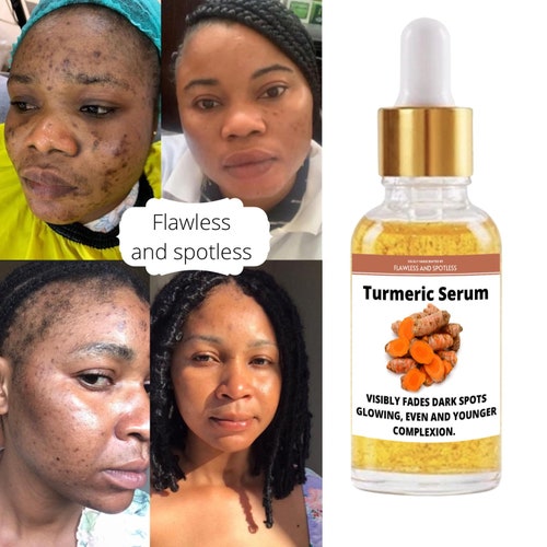 Turmeric Serum Dark Spot Remover Glowing Flawless Skin Dark - Etsy Hong Kong Turmeric Serum Dark Spot Remover Glowing Flawless Skin Dark - Etsy Hong Kong