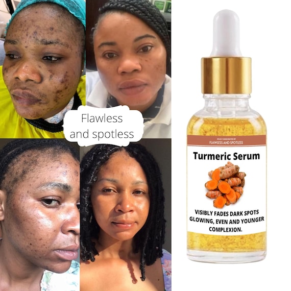 Turmeric Serum, Dark Spot Remover, Glowing Flawless Skin, Dark