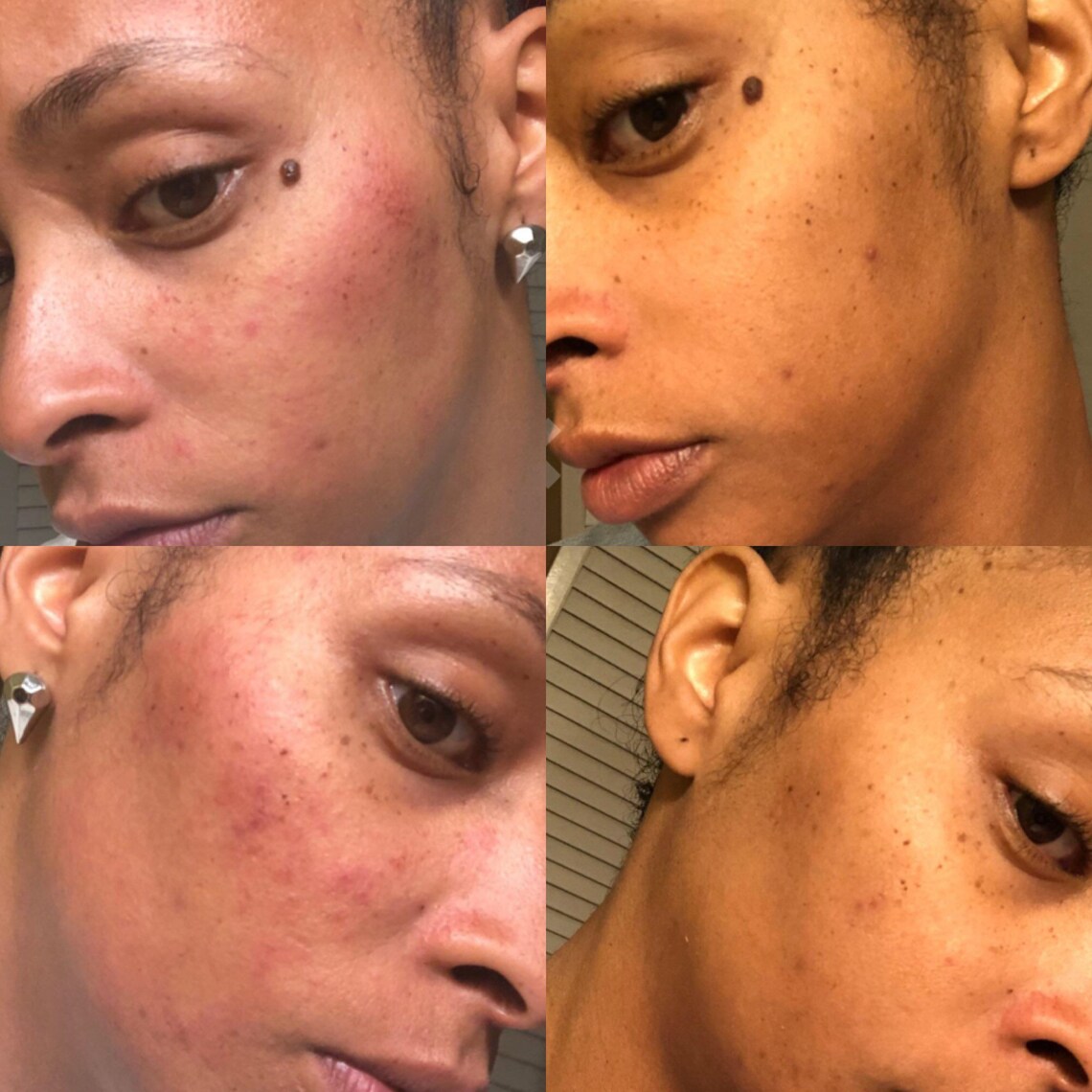 Vitamin C Face Oil Dark Spots Remover Oil Anti Aging Etsy