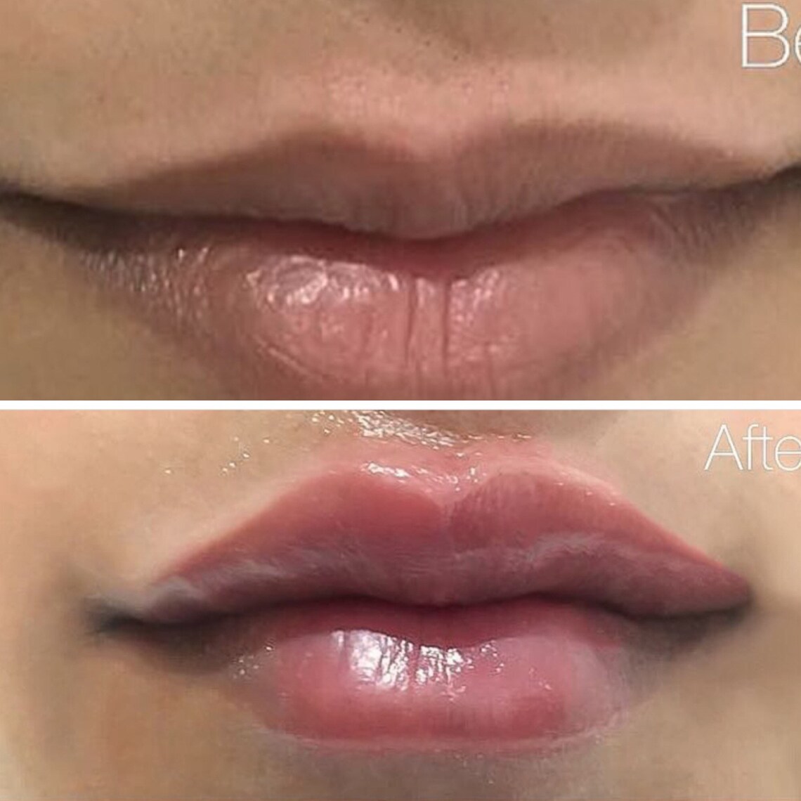 Lip lightening cream smokers lip cream pink lips cream dark Etsy