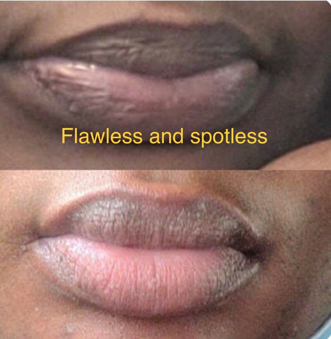 Lip Lightening Cream Smokers Lip Cream Pink Lips Cream Dark Etsy