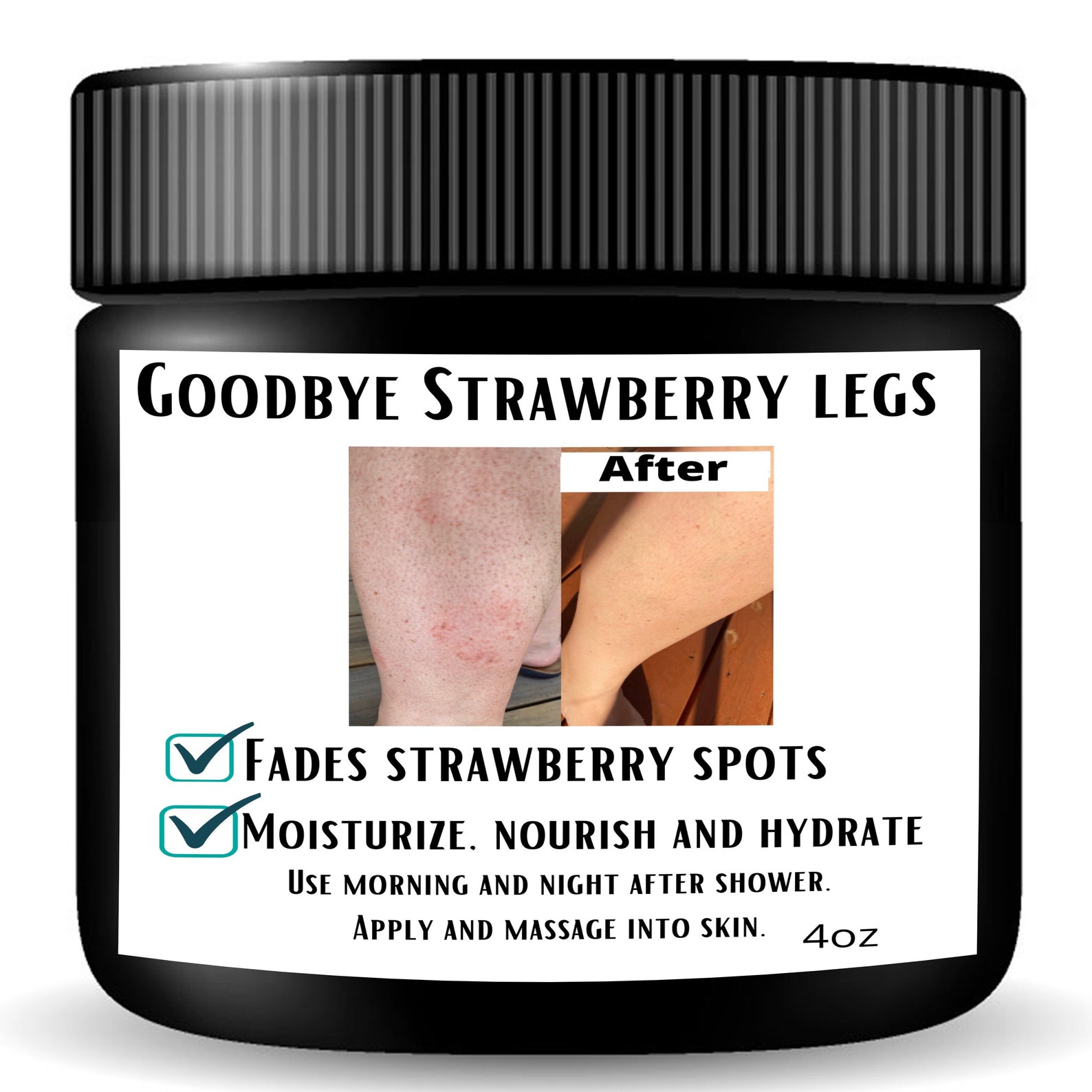 Strawberry Leg Cream Custom Made Cream For keratosis Pilaris Etsy