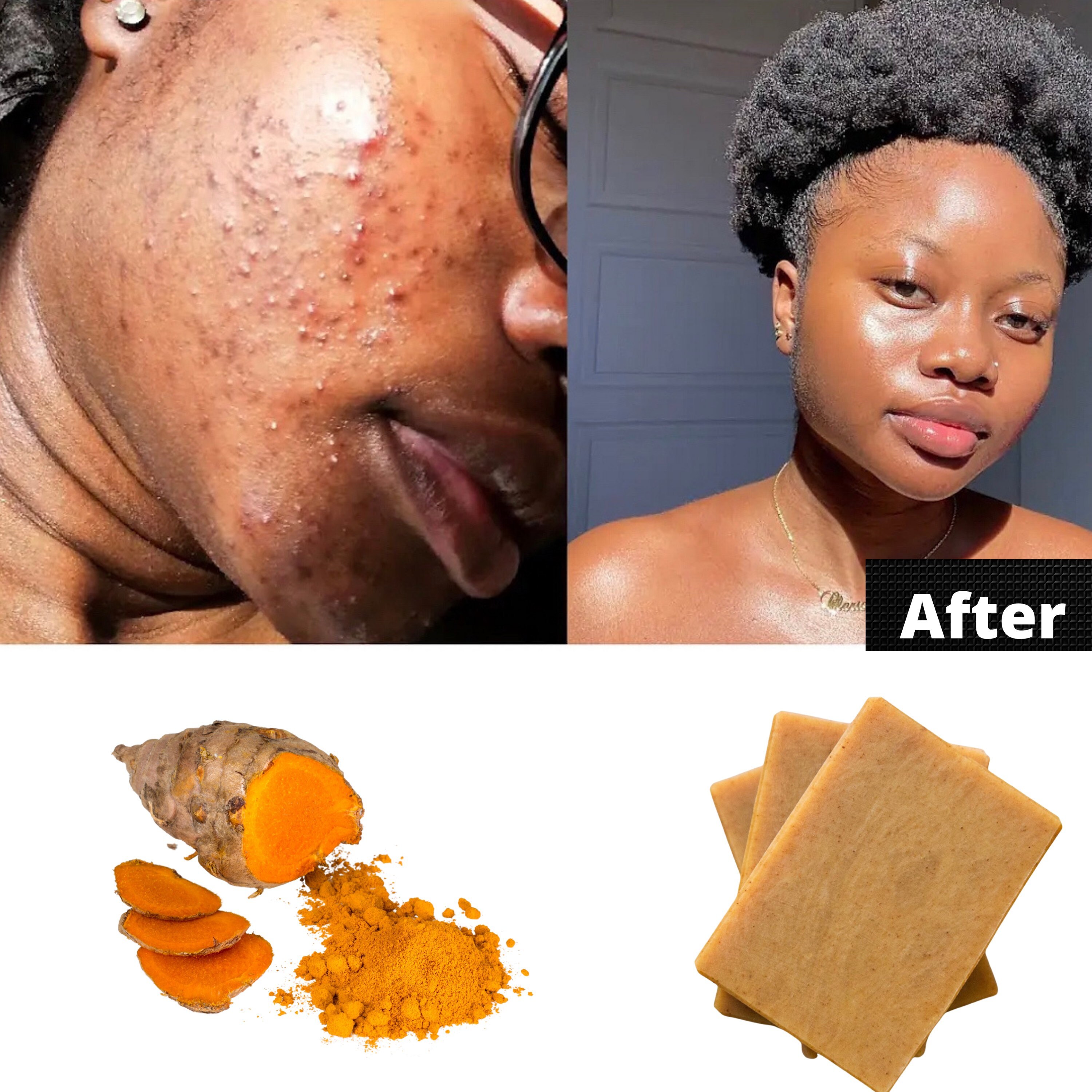 Turmeric aloe Vera bar soap dark spots remover clarifying Etsy