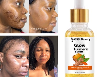 Turmeric Brightening Serum, Dark Spots Remover, Glowing Flawless Skin, Even Skin Serum