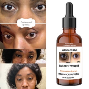 Dark Circles Remover, Under Eye Brightening Serum, intense dark Circle Eraser