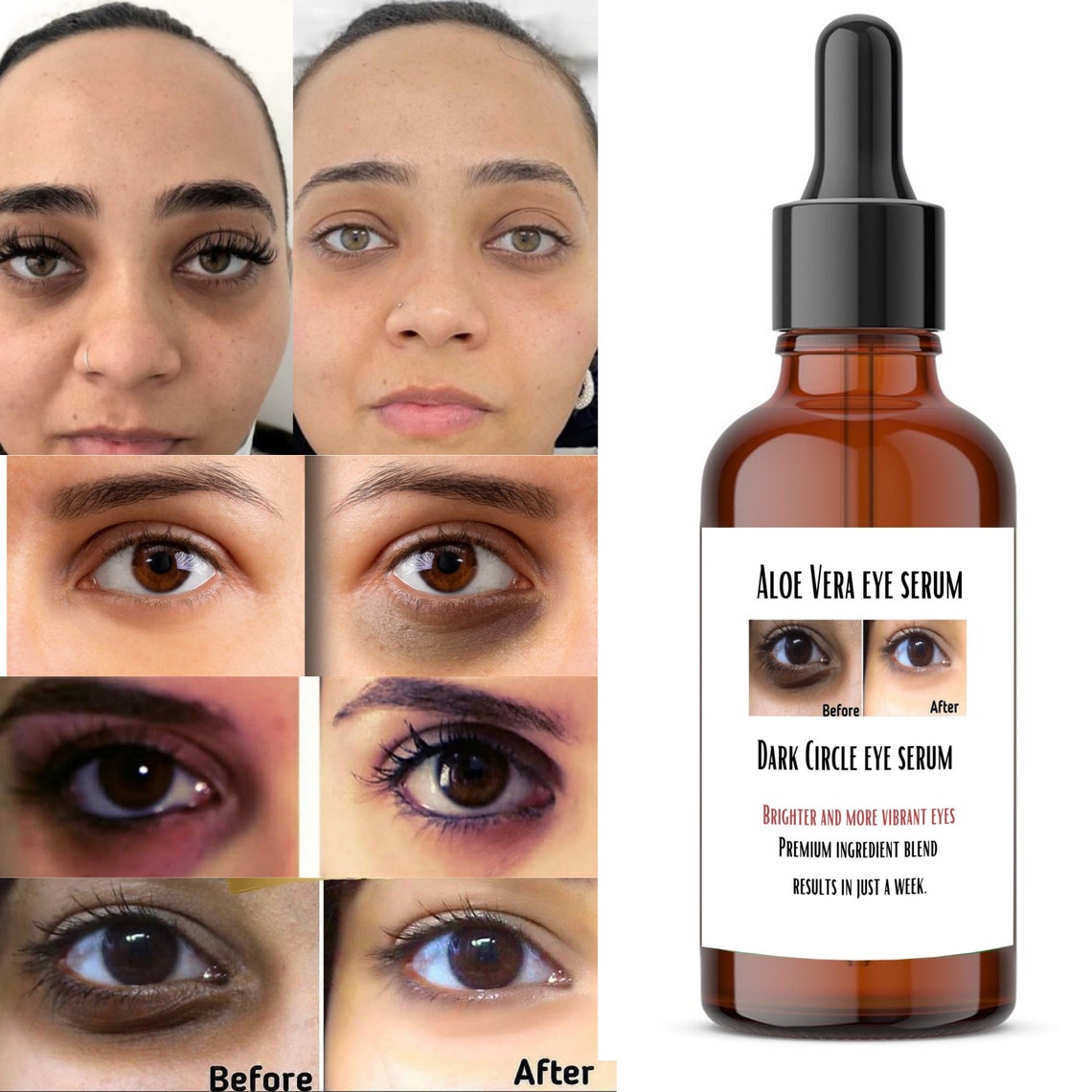 Dark Circles Remover Serum Etsy