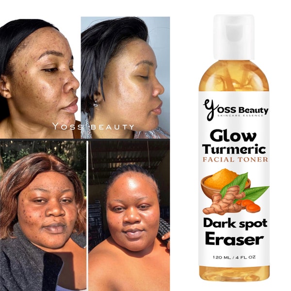 Turmeric Toner, Dark Spot and Blemish toner, Glowing and Even Skin