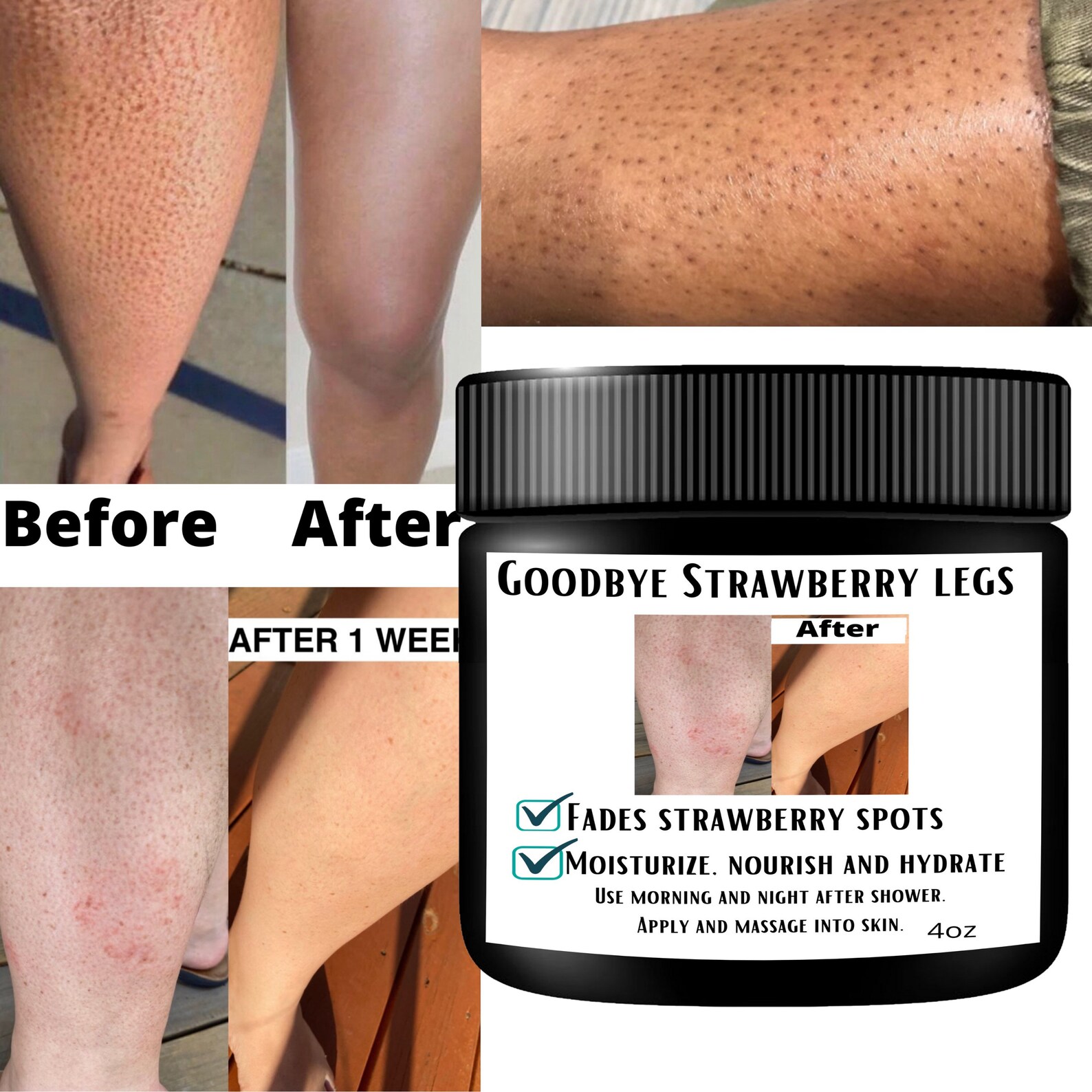 Strawberry Leg Cream Custom Made Cream For keratosis Pilaris Etsy