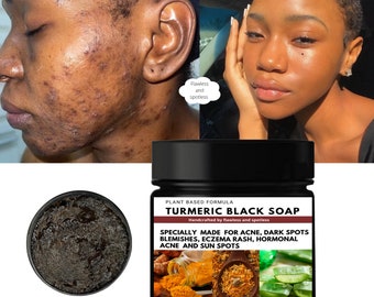 Turmeric Black Soap, Herbal Soap, Plant Based Soap, Acne Soap, Dark Spot Remover, Blemish Soap, Even Skin Tone, Smooth Skin, Glowing Skin