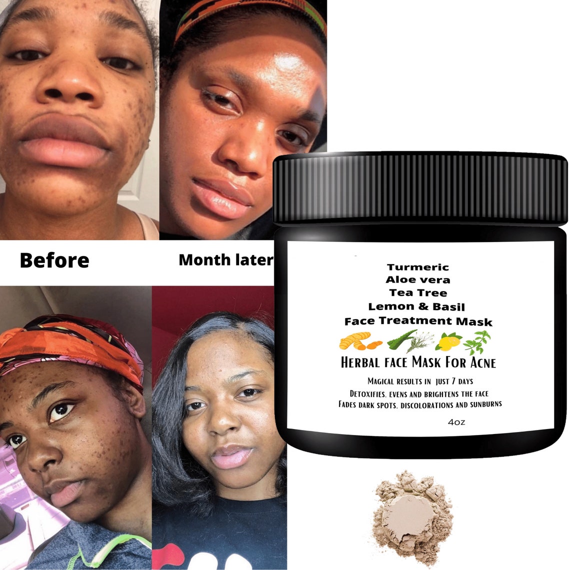 Aloe Vera Turmeric powder Face Mask For Acne Dark Spots Etsy