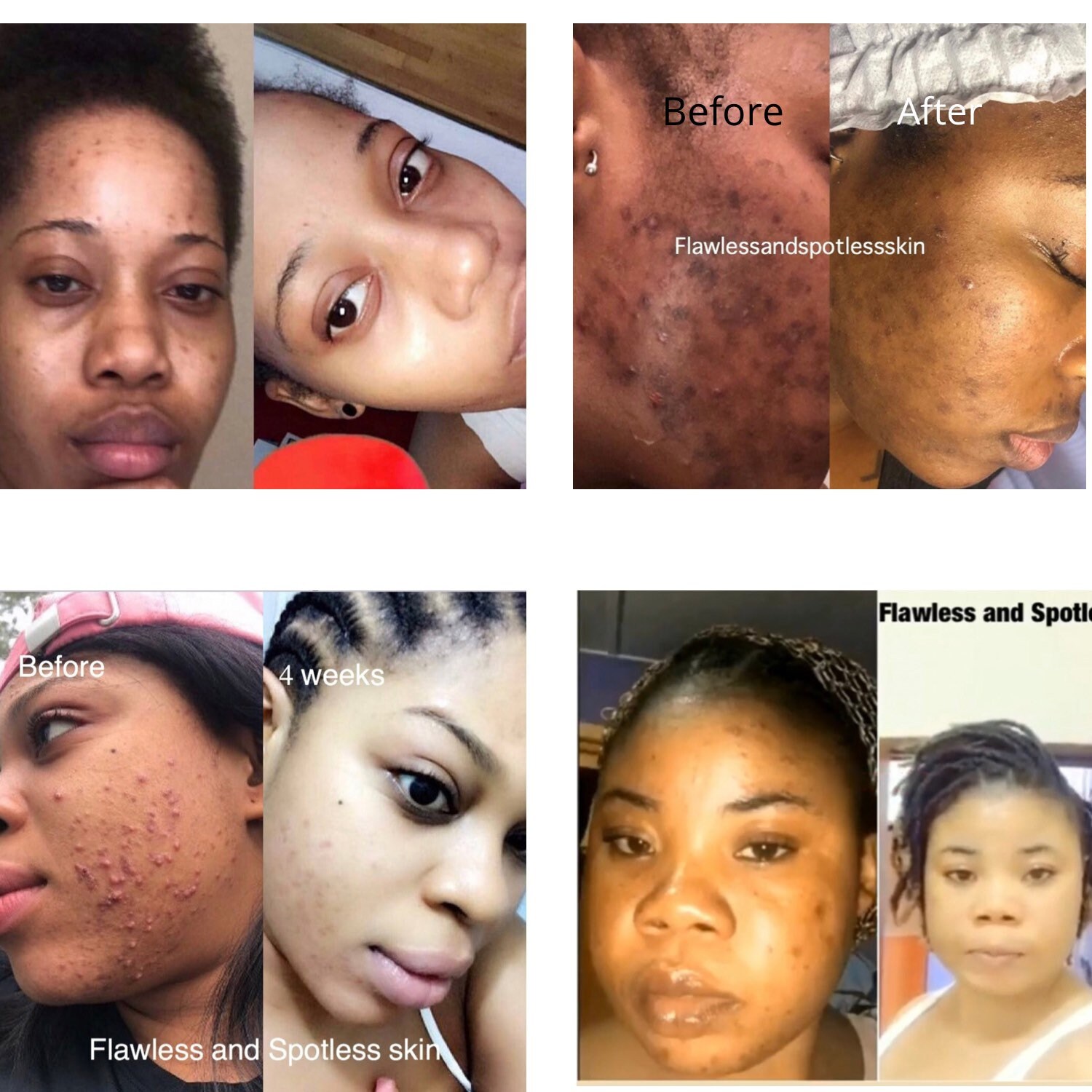 Turmeric face scrub Dark Spots Remover Glowing And Smooth Etsy