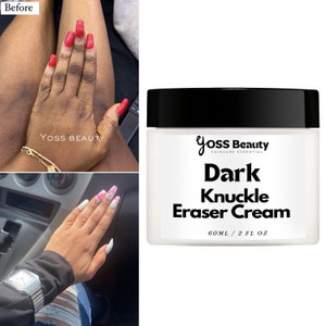 Dark Knuckles Cream, Extra Strong Knuckle Eraser, Even And Glowing Skin