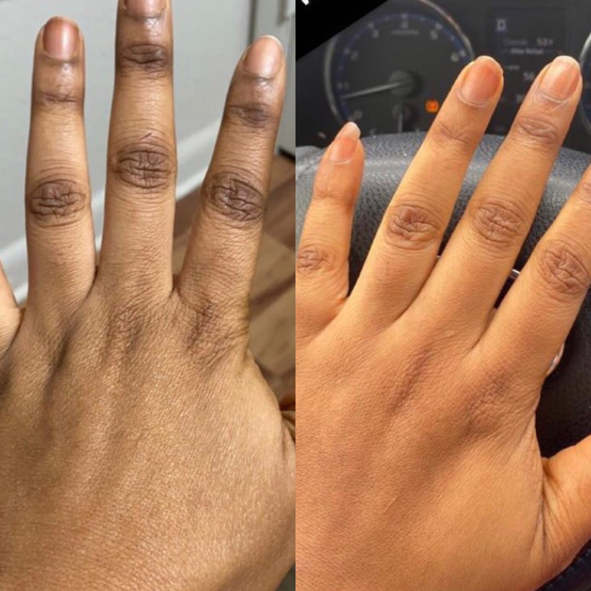 Knuckle whitening intense knuckle remover oil made with Etsy