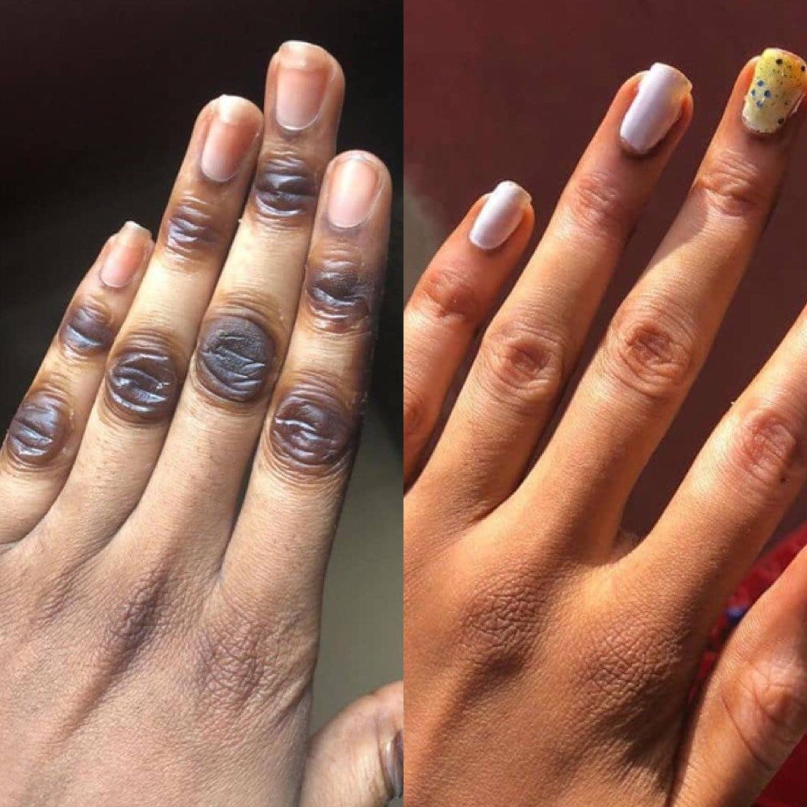 Knuckle whitening intense knuckle remover oil made with Etsy