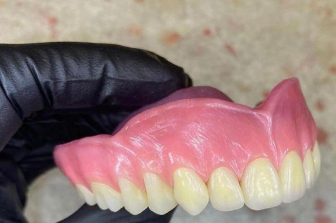 Custom Full Denture Immediate Complete Upper and Lower Set Etsy
