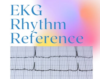 EKG Rhythm Reference