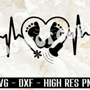 Baby ultrasound SVG, Ultrasound Tech SVG, Ultrasound Wand SVG, baby feet svg, dxf, sonographer svg, sublimation png, cricut vector, clipart