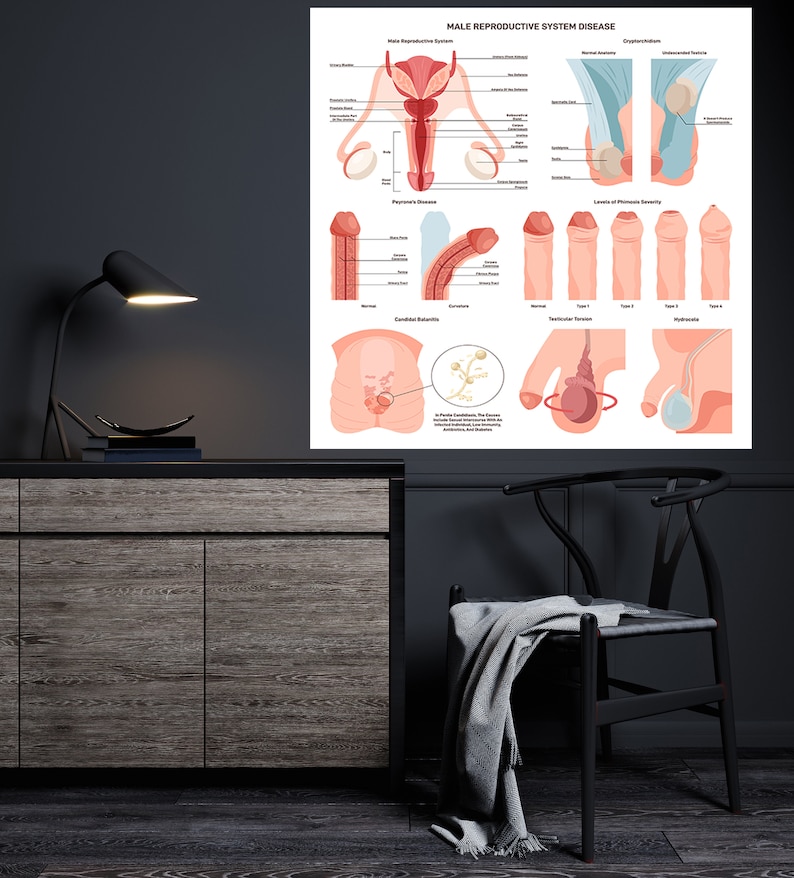 Male Penis Anatomy Wall Art Male Reprod Uctive System Wall Art Extra male-penis-anatomy-wall-art-male-reprod-uctive-system-wall-art-extra