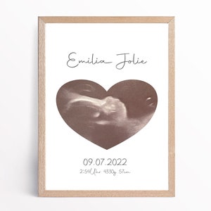 Geburtstafel - Ultraschallbild - Babyposter - Geburtsdatenposter - Geburtstafel -  - Kinderzimmer Dekoration - Personalisiert
