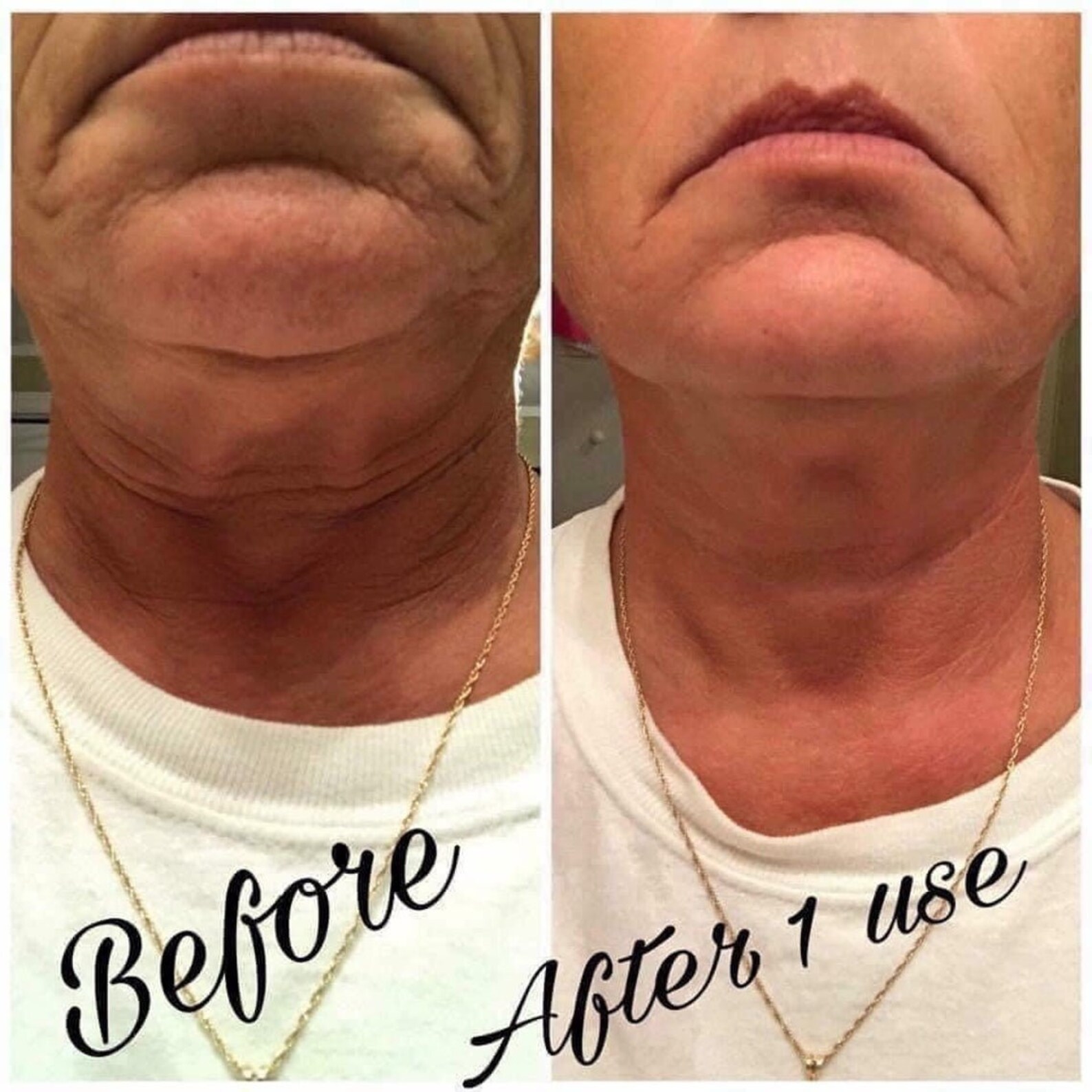 Nu Skin Face Lift Botox in a Bottle Instant Face Lift Etsy