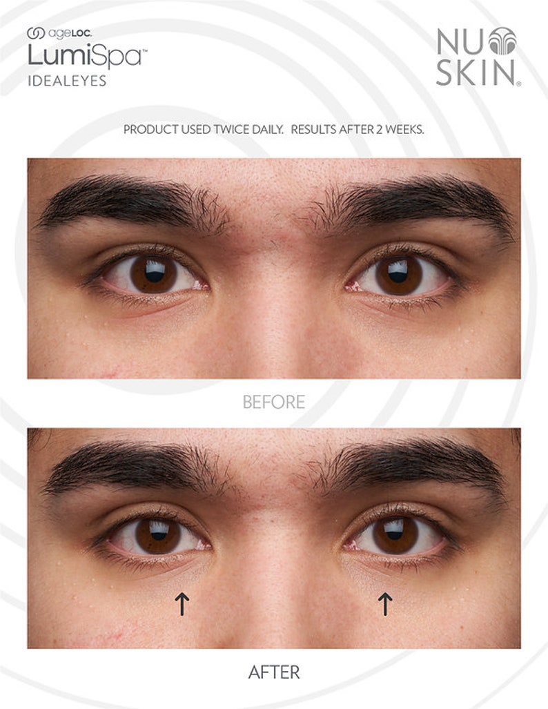 Nu Skin Ideal Eyes Before And After Ageloc Lumispa Ideal Eyes Nu Skin Eye Cream - Etsy