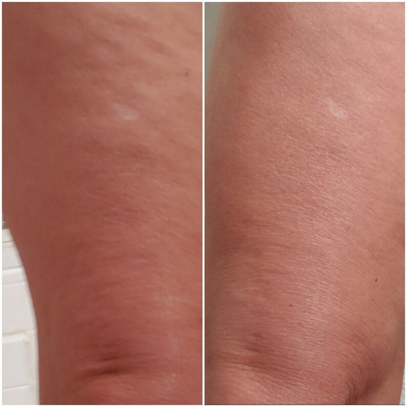 Nu Skin Dermatic Effects Cellulite Cream Fat and Cellulite Etsy