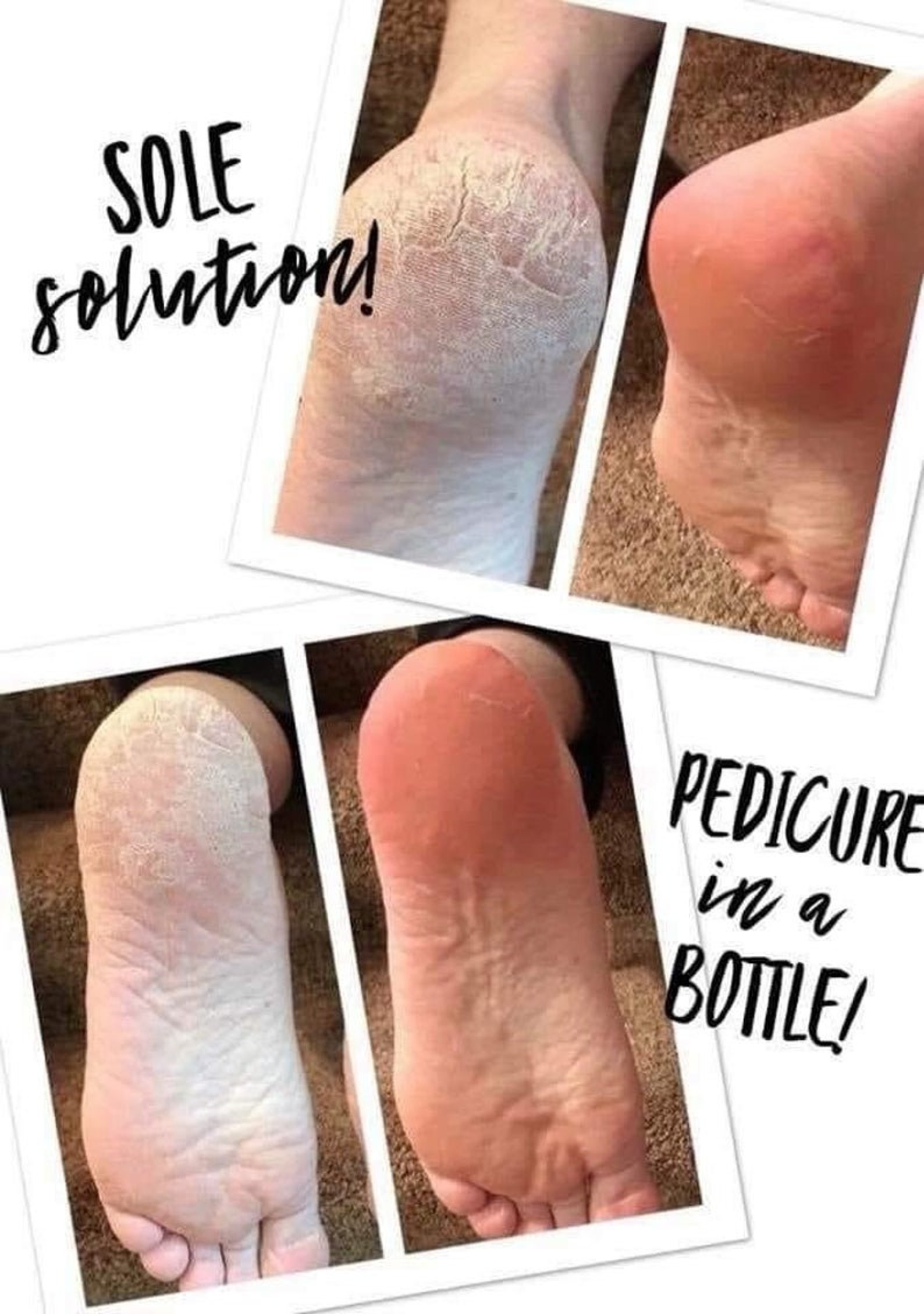 Nuskin Epoch Sole Solution Foot Cream Pedicure in A Bottle Etsy