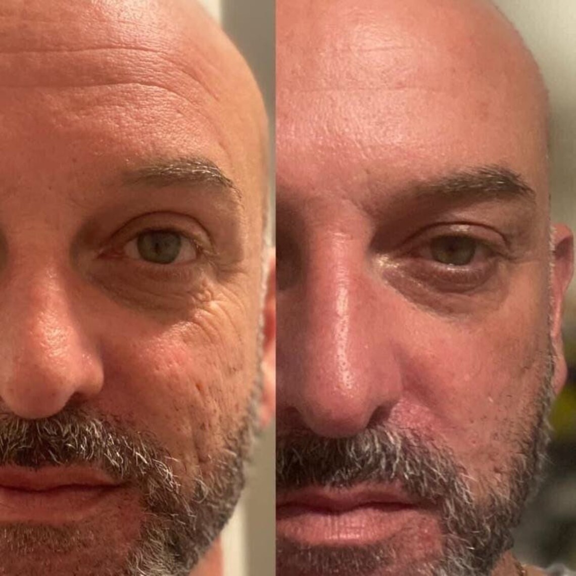 Botox in a Bottle Etsy