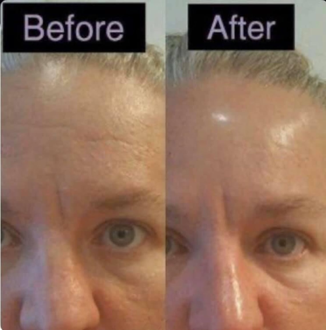 Nu Skin Face Lift Botox in a Bottle Instant Face Lift Etsy