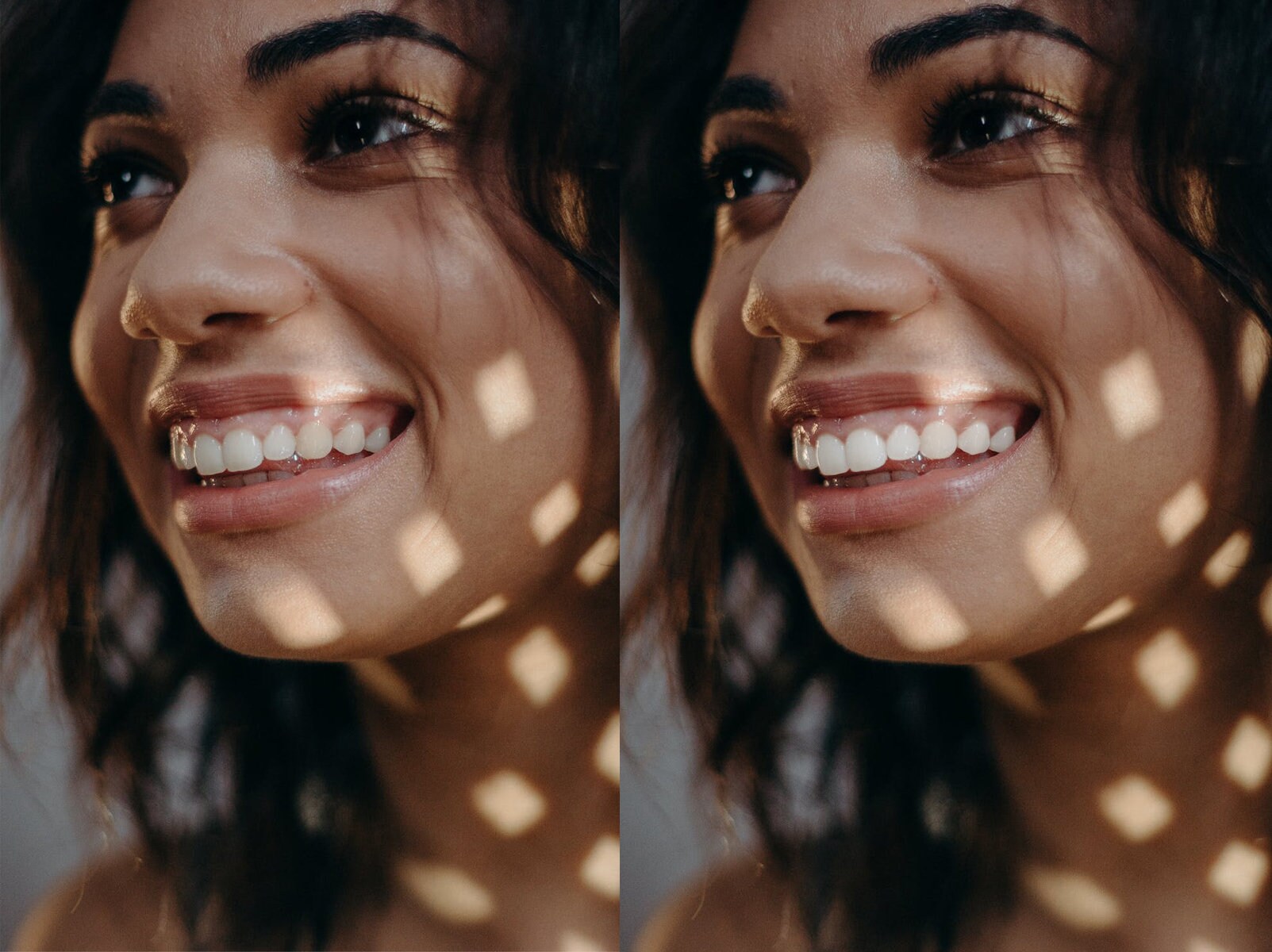 Teeth Whitening Action, Whiten Teeth, Teeth Whitening Preset